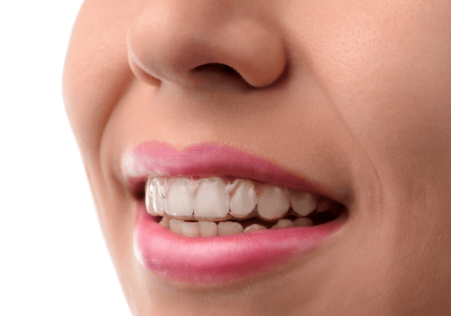 5 Reasons Why It’s Dangerous to Straighten Your Teeth Other than Invisalign Five Reasons Why It's Dangerous to Straighten Your Teeth Other than Invisalign