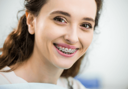 How to Fix Crooked Teeth