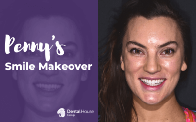 Penny’s Invisalign and Composite Veneers in Sunbury