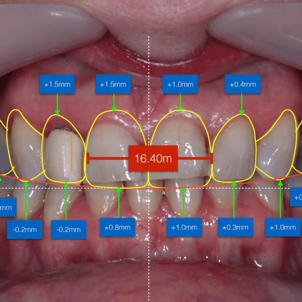 Digital Smile Design