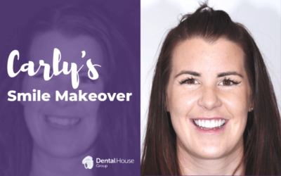 Carly’s Porcelain Veneers & Crowns in Diggers Rest