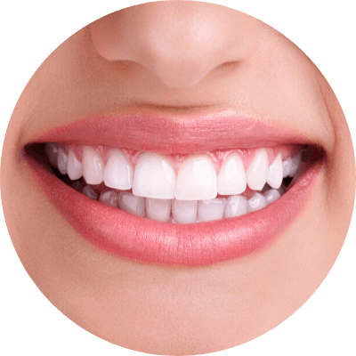 Teeth Whitening