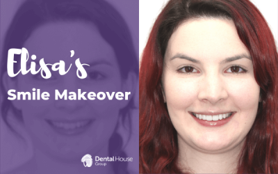 Elisa’s Porcelain Veneers in Sunbury