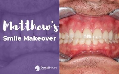 Matthew’s Smile Makeover in Bacchus Marsh
