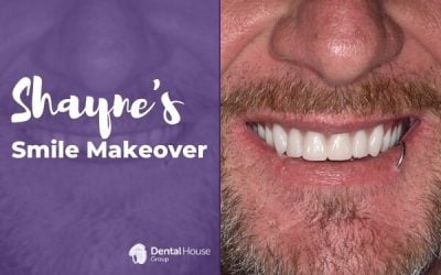 Shayne’s Denture Journey in Melbourne