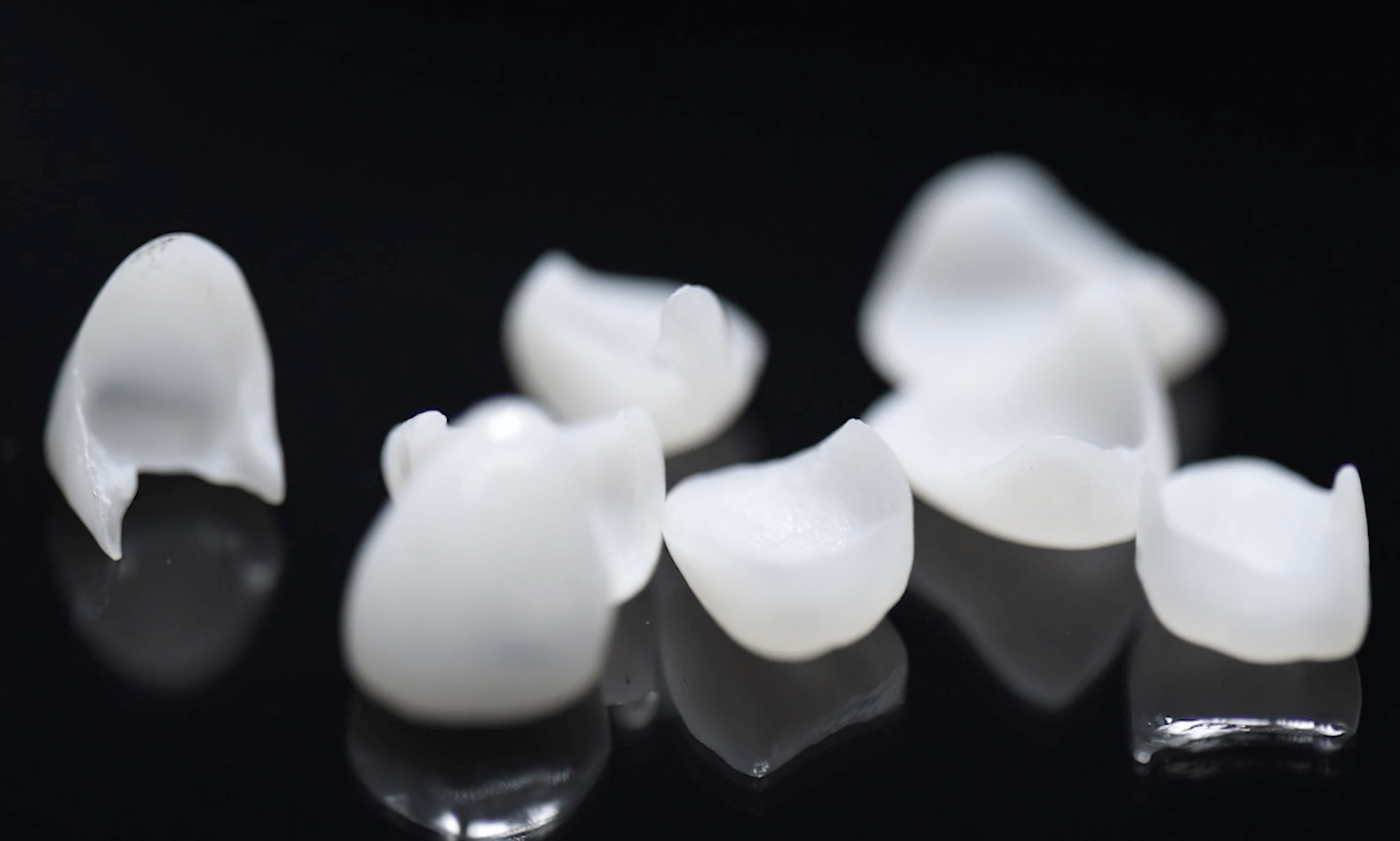 What Is The Cost Of Dental Veneers? Dental Veneers