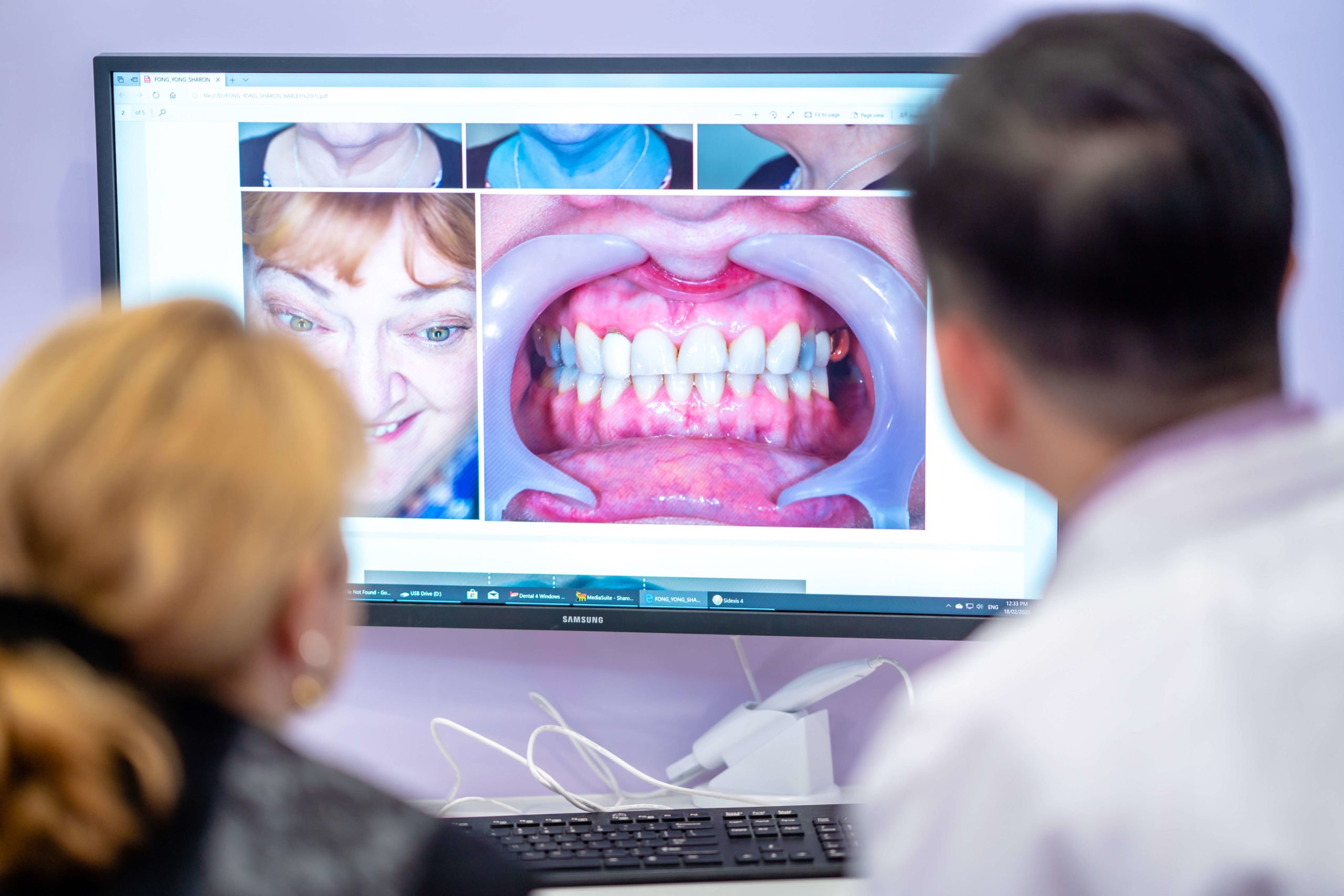 Dental House Veneers