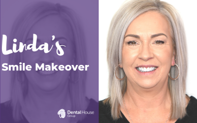 Linda’s Smile Makeover in Sunbury