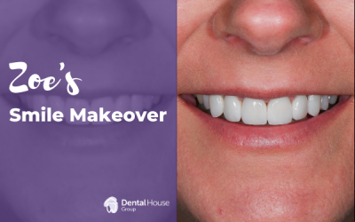 Zoe’s Smile Makeover in Bacchus Marsh