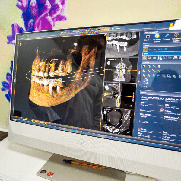 Dental Implant Melbourne_Dental House