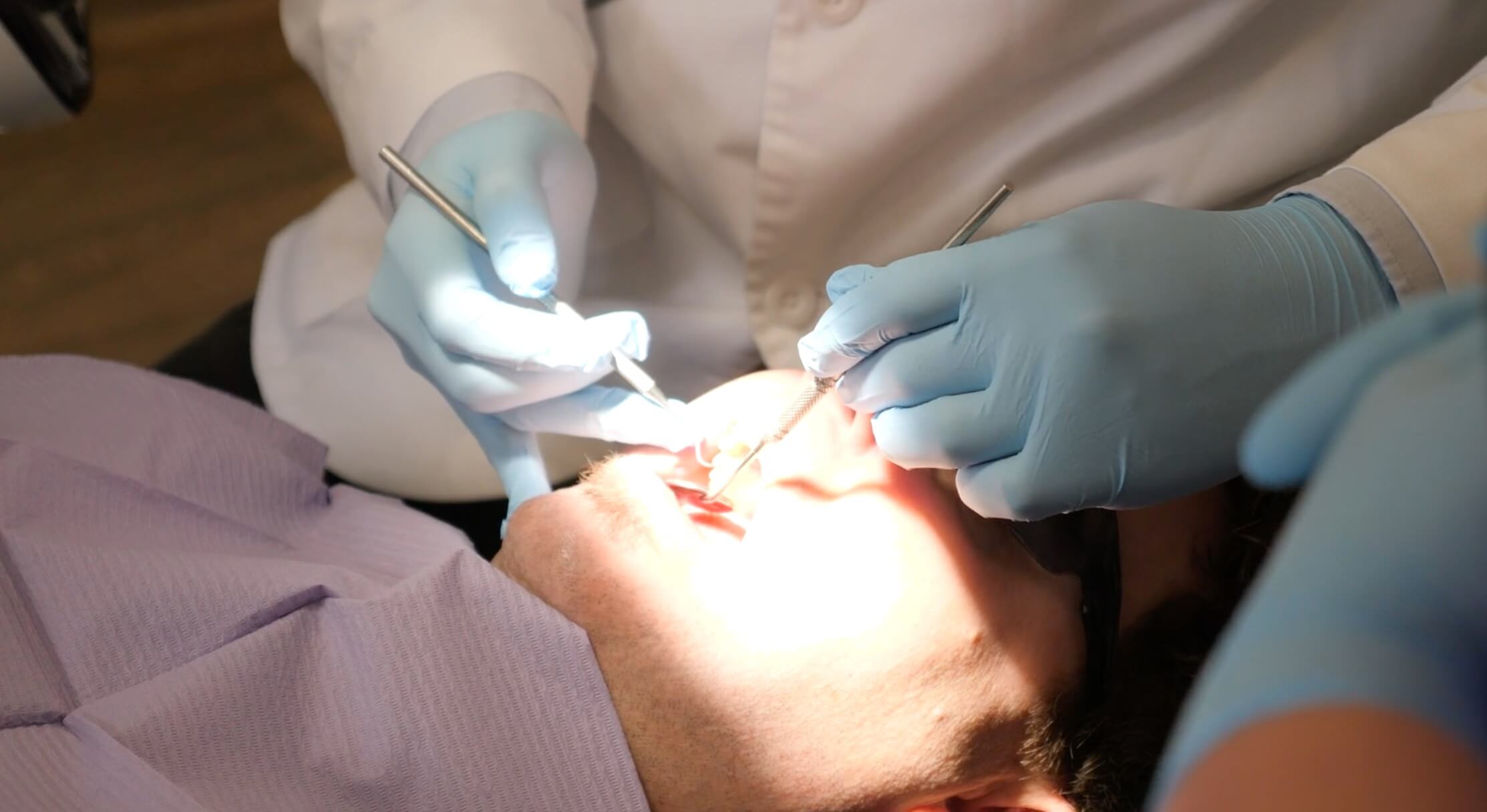 Discoloured Teeth