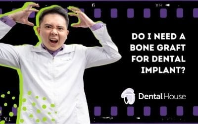 Do I Need Bone Graft for Dental Implant?