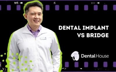 Dental Implant Versus Bridge