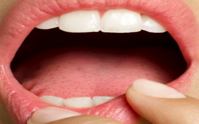 Surprising Facts About Your Tongue: Beyond Taste, Talking & Kissing
