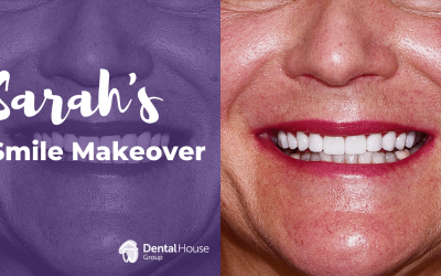 Sarah’s Porcelain Veneers Journey in Sunbury
