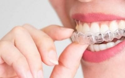 What to Know about Invisalign and Its Effectiveness