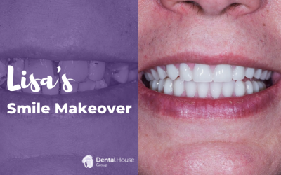 April’s Smile Makeover in Melbourne