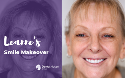 Leanne’s Porcelain Crown & Veneers in Melbourne