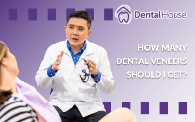 How Many Dental Veneers Should I Get?