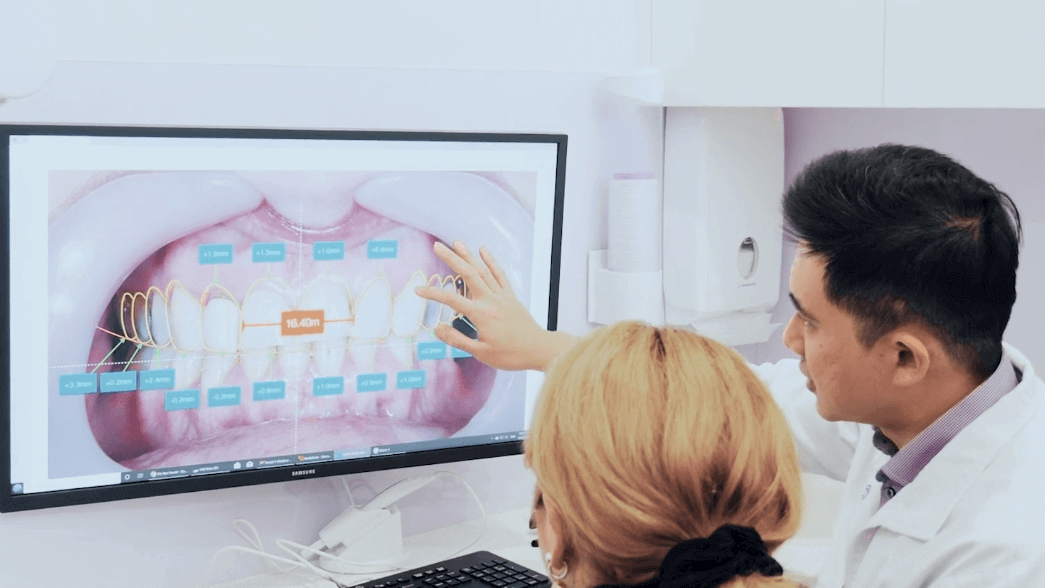 What is the Process of Dental Veneers