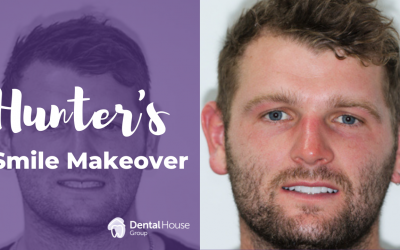 Hunter’s Smile Makeover in Melbourne