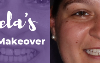 Daniela’s Smile Makeover in Bacchus Marsh