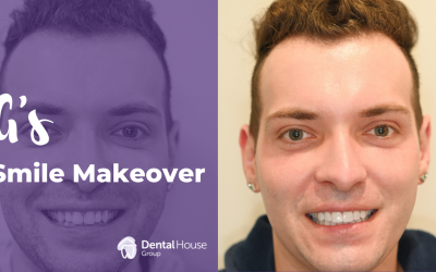 G’s Smile Makeover in Melbourne