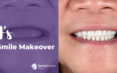 J’s Smile Makeover in Sunbury