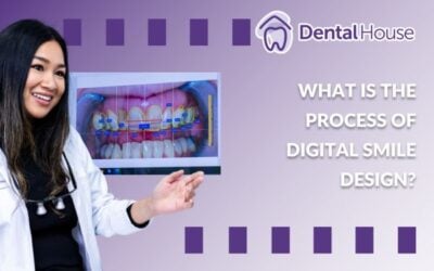 What Is the Process of Digital Smile Design?