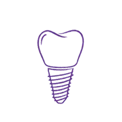 implants