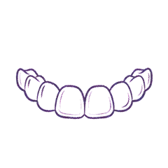 invisalign